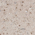 Immunohistochemical staining of human cerebral cortex shows moderate membranous positivity in microglia.