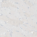 Anti-ALDH7A1 Antibody