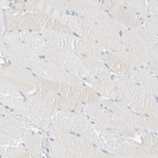 Immunohistochemical staining of human skeletal muscle shows no positivity in myocytes as expected.