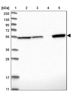 Lane 1: Marker [kDa] 230, 130, 95, 72, 56, 36, 28, 17, 11_br/_Lane 2: Human cell line RT-4_br/_Lane 3: Human cell line U-251MG sp_br/_Lane 4: Human plasma (IgG/HSA depleted)_br/_Lane 5: Human liver tissue