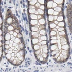 Immunohistochemical staining of human colon using Anti-CTH antibody HPA023300.