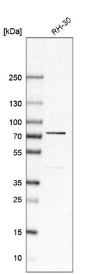Western blot analysis in human cell line RH-30.