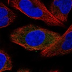 Immunofluorescent staining of human cell line U-2 OS shows localization to cytosol.
