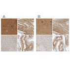Immunohistochemical staining of human cerebral cortex, heart muscle, liver and testis using Anti-TOM1L2 antibody HPA023304 (A) shows similar protein distribution across tissues to independent antibody HPA022541 (B).