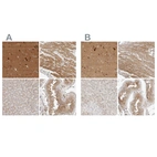 Immunohistochemical staining of human cerebral cortex, heart muscle, liver and testis using Anti-TOM1L2 antibody HPA023304 (A) shows similar protein distribution across tissues to independent antibody HPA022541 (B).