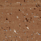 Immunohistochemical staining of human cerebral cortex shows strong cytoplasmic positivity in neurons.