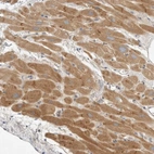 Immunohistochemical staining of human heart muscle shows moderate granular cytoplasmic positivity in cardiomyocytes.