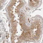 Immunohistochemical staining of human testis shows moderate granular cytoplasmic positivity in cells in seminiferous ducts.