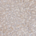 Immunohistochemical staining of human liver shows very weak cytoplasmic positivity in hepatocytes.