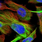 Immunofluorescent staining of human cell line U-251 MG shows localization to intermediate filaments.