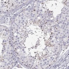 Anti-FAM166A Antibody