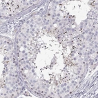 Immunohistochemical staining of human testis shows high expression.