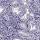Immunohistochemical staining of human endometrium shows low expression as expected.