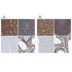 Immunohistochemical staining of human cerebral cortex, lymph node, skeletal muscle and testis using Anti-SEPT7 antibody HPA023309 (A) shows similar protein distribution across tissues to independent antibody HPA029524 (B).