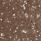 Immunohistochemical staining of human cerebral cortex shows positivity in neuropil.