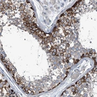 Immunohistochemical staining of human testis shows positivit in cells in seminiferous ducts.
