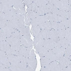 Immunohistochemical staining of human skeletal muscle shows no positivity in myocytes as expected.
