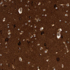 Immunohistochemical staining of human cerebral cortex shows strong cytoplasmic positivity in neurons.
