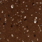 Immunohistochemical staining of human cerebral cortex shows strong cytoplasmic positivity in neurons.