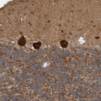 Immunohistochemical staining of human cerebellum shows strong cytoplasmic positivity in Purkinje cells.