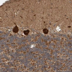 Immunohistochemical staining of human cerebellum shows strong cytoplasmic positivity in Purkinje cells.