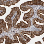 Immunohistochemical staining of human fallopian tube shows moderate to strong cytoplasmic positivity in glandular cells.