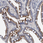 Immunohistochemical staining of human Duodenum shows moderate membranous and cytoplasmic positivity in glandular cells.