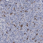 Immunohistochemical staining of human Pancreas shows moderate membranous and cytoplasmic positivity in exocrine glandular cells.