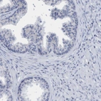 Immunohistochemical staining of human Prostate shows no positivity in glandular cells.