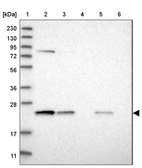 Lane 1: Marker [kDa] 230, 130, 95, 72, 56, 36, 28, 17, 11_br/_Lane 2: Human cell line RT-4_br/_Lane 3: Human cell line U-251MG sp_br/_Lane 4: Human plasma (IgG/HSA depleted)_br/_Lane 5: Human liver tissue_br/_Lane 6: Human tonsil tissue