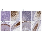Immunohistochemical staining of human lymph node, skin, skin and skin, hairy using Anti-GSDMA antibody HPA023313 (A) shows similar protein distribution across tissues to independent antibody HPA064826 (B).