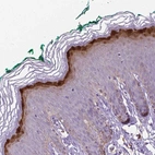 Immunohistochemical staining of human skin shows moderate to strong cytoplasmic positivity in keratinocytes.