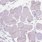 Immunohistochemical staining of human skeletal muscle shows no positivity in myocytes.