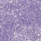 Immunohistochemical staining of human lymph node using Anti-GSDMA antibody HPA023313.