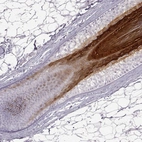 Immunohistochemical staining of human skin, hairy using Anti-GSDMA antibody HPA023313.