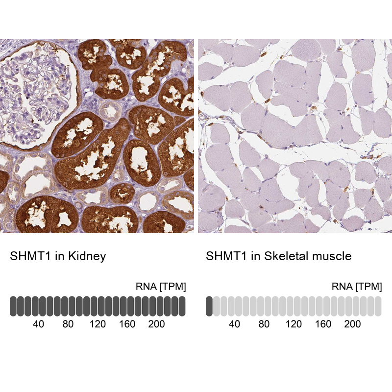 Anti-SHMT1 Antibody