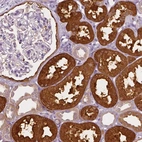 Immunohistochemical staining of human kidney shows strong cytoplasmic positivity in cells in tubules.