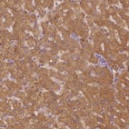 Immunohistochemical staining of human liver shows strong cytoplasmic positivity in hepatocytes.