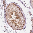 Immunohistochemical staining of human testis shows moderate to strong cytoplasmic positivity in cells in seminiferous ducts.