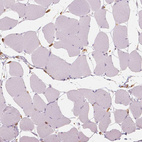 Immunohistochemical staining of human skeletal muscle shows no positivity in myocytes as expected.
