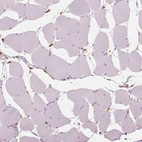 Immunohistochemical staining of human skeletal muscle shows no positivity in myocytes as expected.