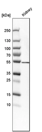 Western blot analysis in human kidney tissue.