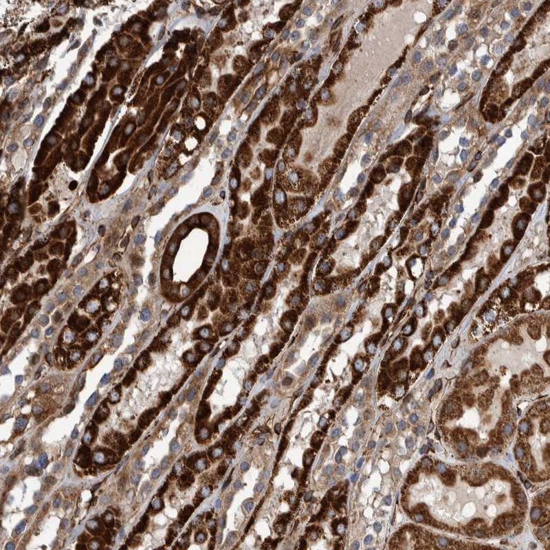 Anti-CCDC57 Antibody