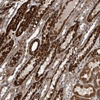 Anti-CCDC57 Antibody