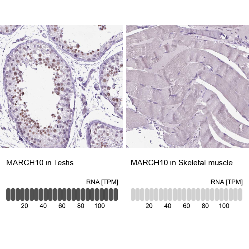 Anti-MARCH10 Antibody