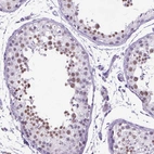 Immunohistochemical staining of human testis shows strong nuclear positivity in spermatocytes in seminiferous ducts.