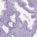 Immunohistochemical staining of human prostate shows no nuclear positivity in glandular cells as expected.