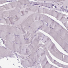 Immunohistochemical staining of human skeletal muscle shows no nuclear positivity in myocytes as expected.