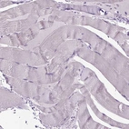 Immunohistochemical staining of human skeletal muscle shows no nuclear positivity in myocytes as expected.