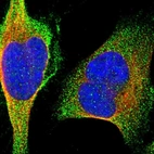 Immunofluorescent staining of human cell line U-2 OS shows localization to plasma membrane & cytosol.